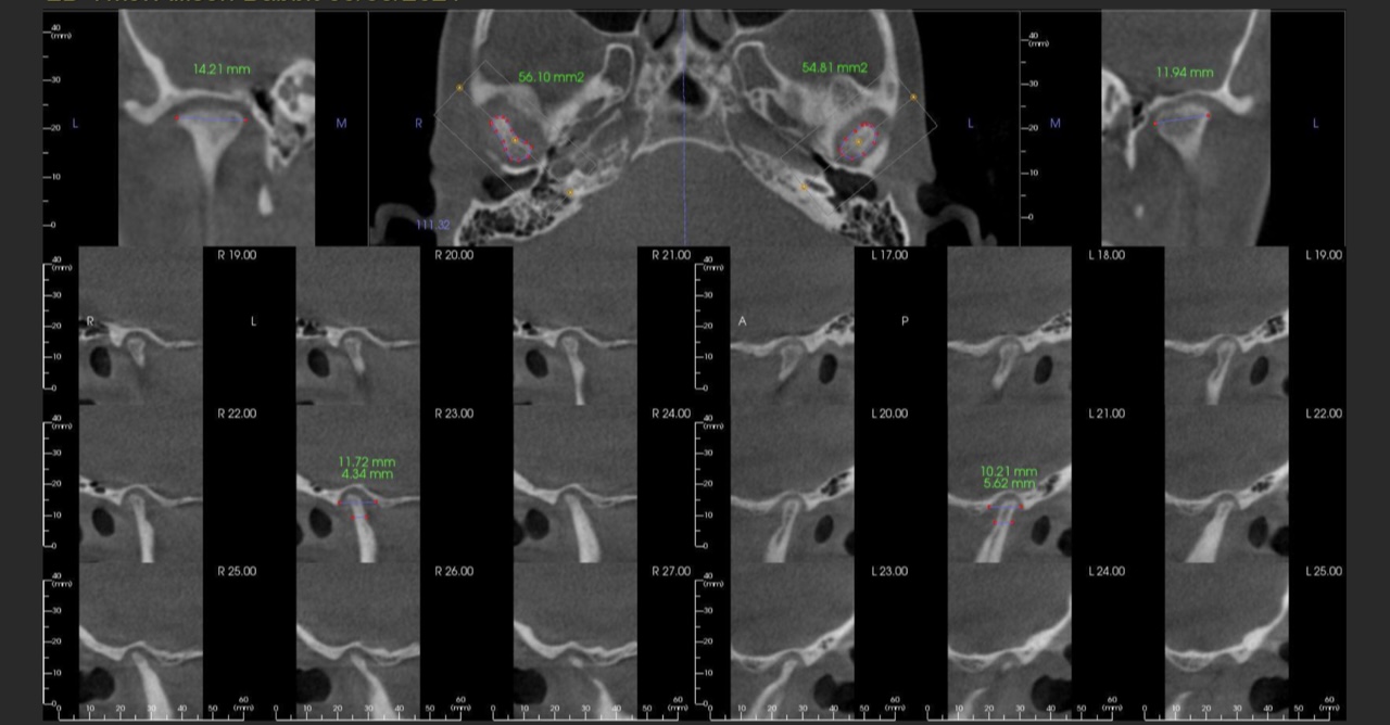 Advanced Occlusion Study Club: Global Diagnosis Mastery Course