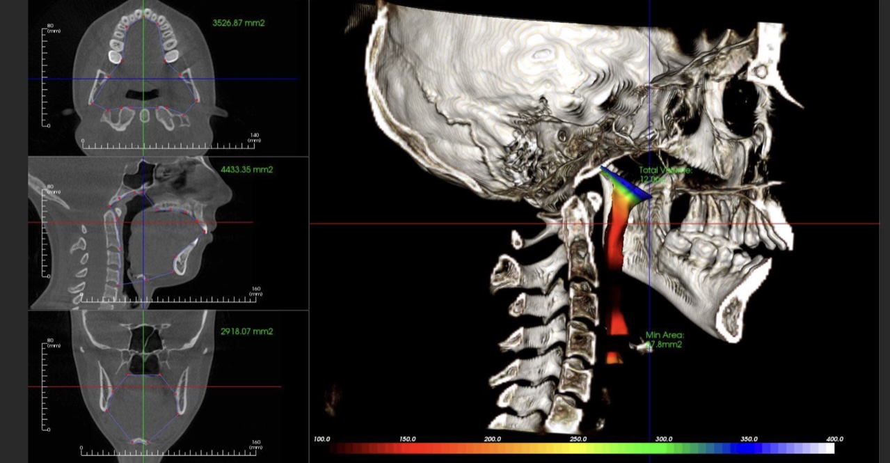 Advanced Occlusion Study Club: Global Diagnosis Mastery Course